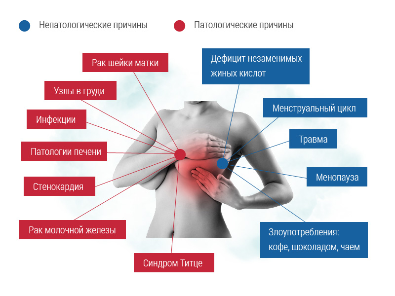 ПМС или беременность ПМС или беременность