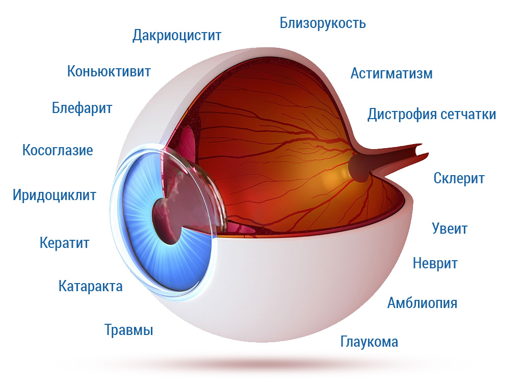 Институт лечения глаз федорова