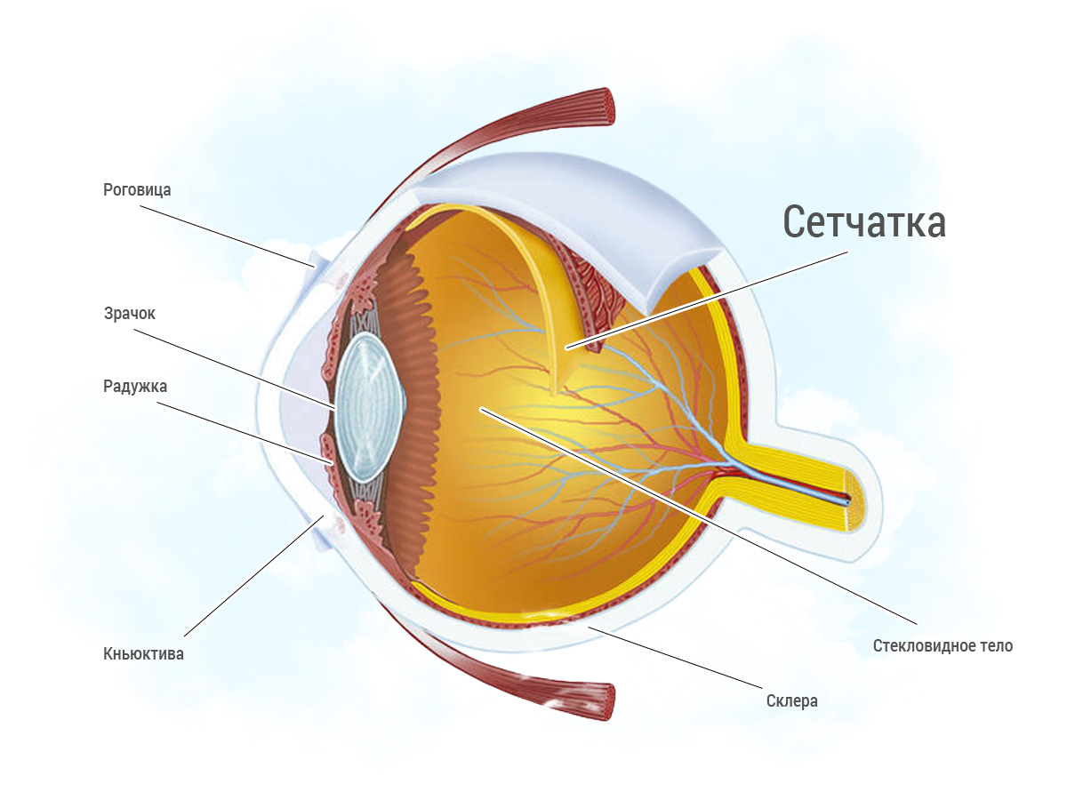 Отслойка сосудистой глаза лечение thumbnail