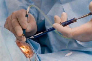 Современные методы хирургического лечения глаукомы